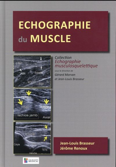 Echographie du muscle