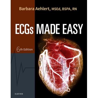 Pocket Guide For ECGs Made Easy - E-Book Pocket Guide For ECGs Made ...