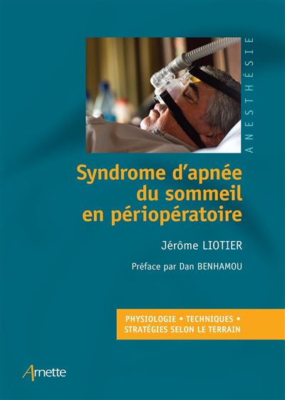Syndrome d'apnée du sommeil en périopératoire - Jérôme Liotier - broché