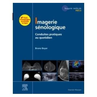 Imagerie sénologique