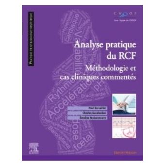 Analyse pratique du RCF : rythme cardiaque foetal