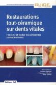 Restaurations tout ceramique sur dents vitales