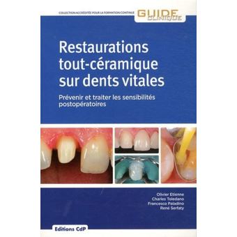 Restaurations tout ceramique sur dents vitales