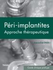Les péri-implantites