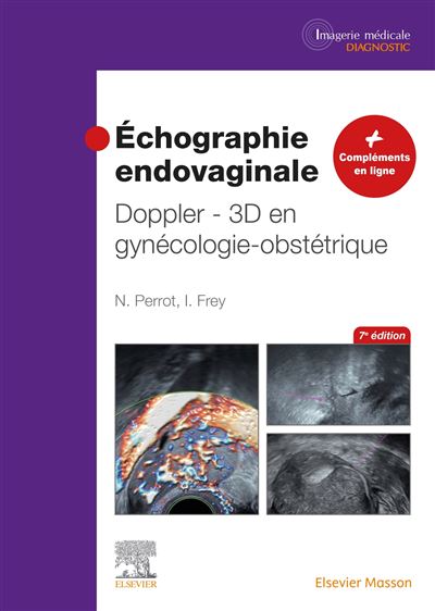 Échographie endovaginale Doppler