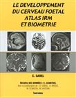 Developpement du cerveau foetal