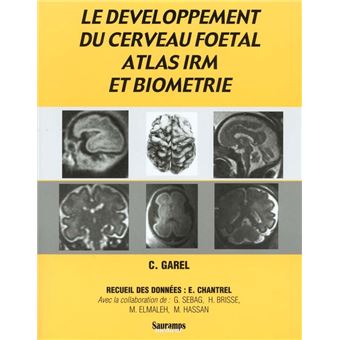 Developpement du cerveau foetal
