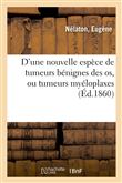D'une nouvelle espèce de tumeurs bénignes des os, ou tumeurs myéloplaxes