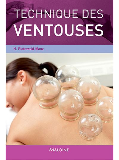 Technique des ventouses