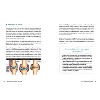 Les aliments qui soignent l'arthrose