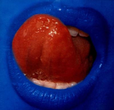 Blue lipss
