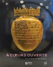 À coeurs ouverts