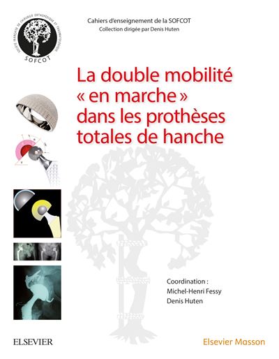 La double mobilité dans les prothèses totales de hanche