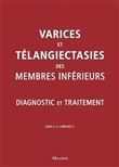 Varices et teleangiecasties des membres inferieurs