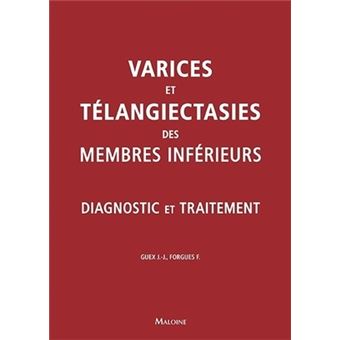 Varices et teleangiecasties des membres inferieurs