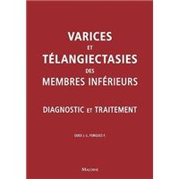 Varices et teleangiecasties des membres inferieurs