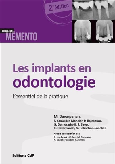 Les implants en odontologie