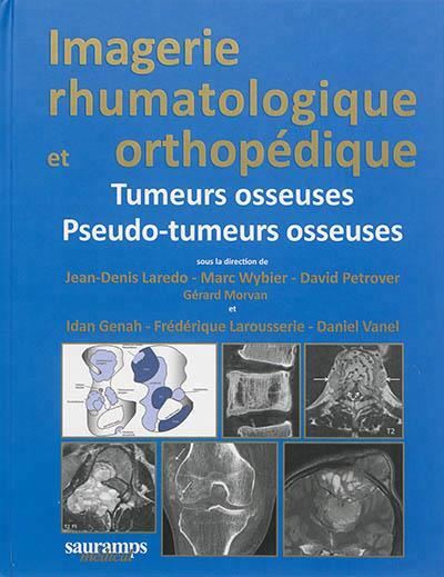 Imagerie rhumatologique et orthopedique,4:tumeurs osseuses