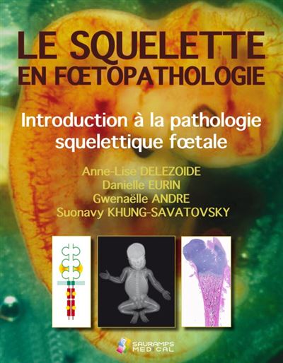 Le squelette en foetopathologie