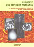 Imagerie des tumeurs osseuses