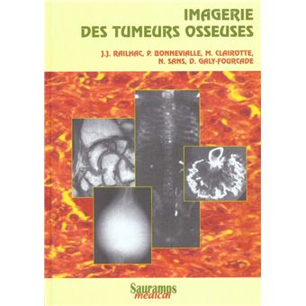 Imagerie des tumeurs osseuses