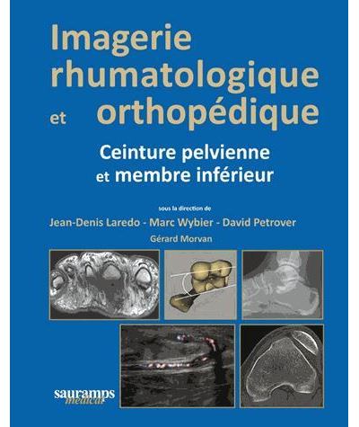 Imagerie Rhumatologique Et Orthopedique Tome 3- Ceinture Pelvienne Et M ...