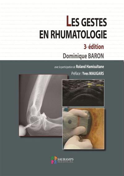 Les gestes en rhumatologie 3ed