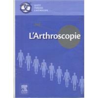L'arthroscopie
