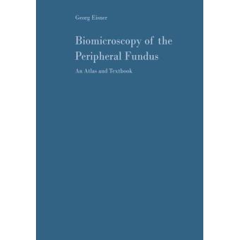 Biomicroscopy of the Peripheral Fundus - 1