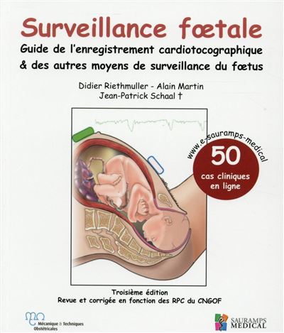 Surveillance foetale - guide de l'enregistrement cardiotocographique & autres mo