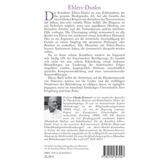 Ehlers-Danlos