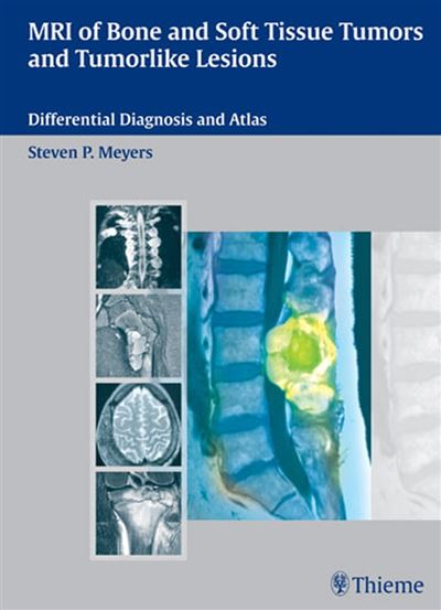 MRI of Bone and Soft Tissue Tumors and Tumorlike Lesions Differential ...