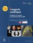 Imagerie cardiaque
