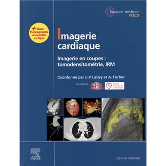 Imagerie cardiaque