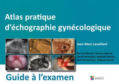 Atlas pratique d'échographie gynécologique