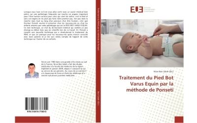 Traitement du pied bot varus equin par la methode de ponseti