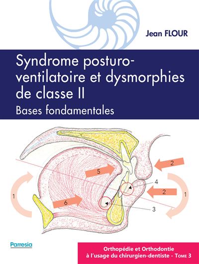Syndrome posturo-ventilatoire et dysmorphies de classe 2 bas