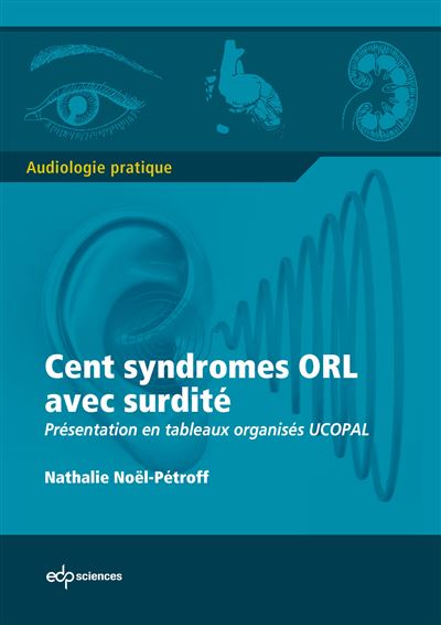 100 syndromes orl avec surdité