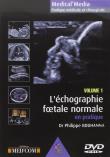 L echographie foetale normale  vol 1