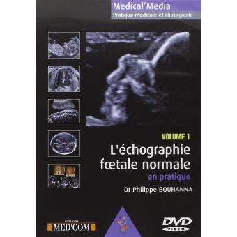 L echographie foetale normale  vol 1