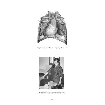 Ouvrez vos ailes grâce à la libération du péricarde