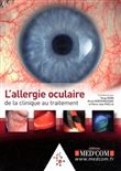 L allergie oculaire de la clinique au traitement