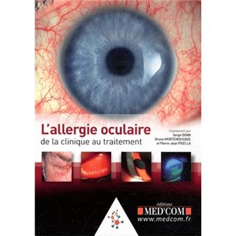 L allergie oculaire de la clinique au traitement