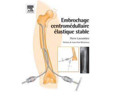 embrochage centromédullaire élastique stable - broché - Pierre, Livre ...