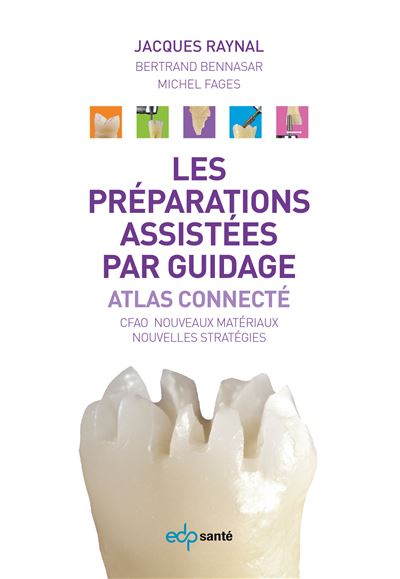 Preparations assistees par guidage, atlas connecte