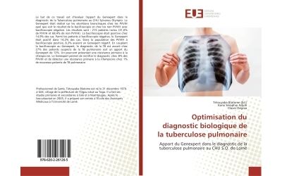 Optimisation du diagnostic biologique de la tuberculose pulm