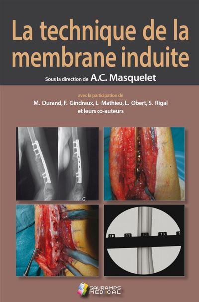 La technique de la membrane induite - Alain-Charles Masquelet - broché