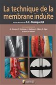 La technique de la membrane induite