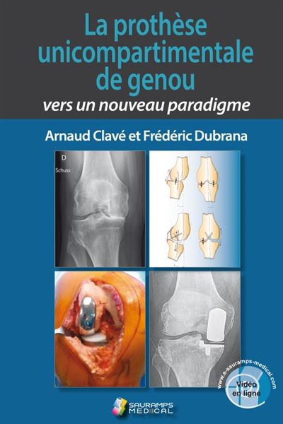 La prothese unicompartimentale de genou. vers un nouveau paradigme - Arnaud Clavé - broché