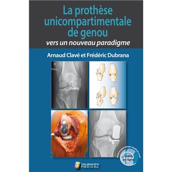 La prothese unicompartimentale de genou. vers un nouveau paradigme
